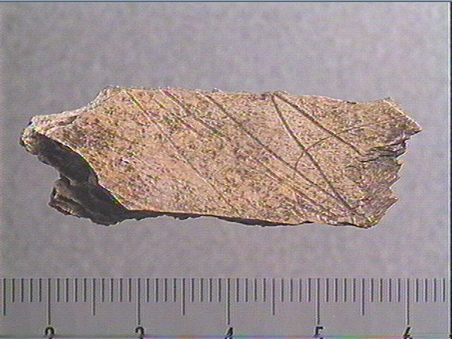 scapula