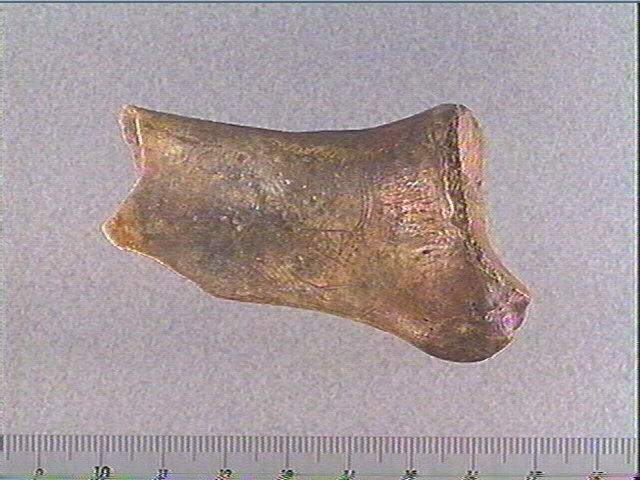 scapula