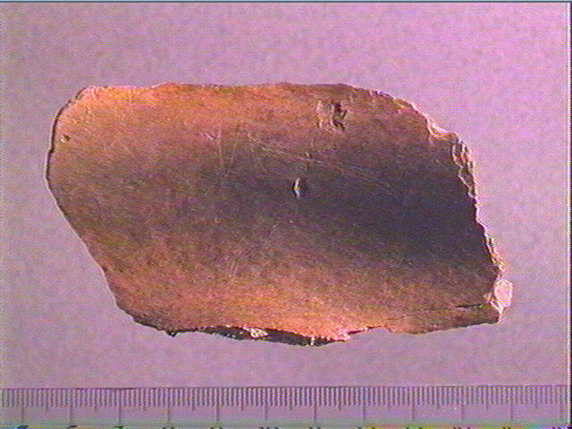 scapula
