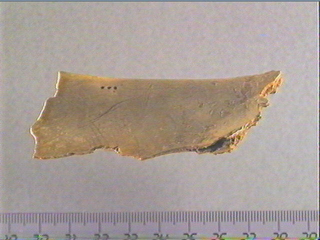 scapula
